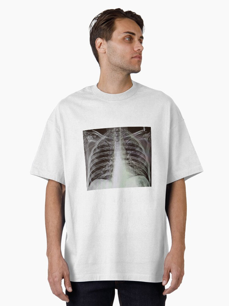 Chest X-Ray Oversized T-Shirt | Premium Unisex T-Shirt, Trending Graphic Tee